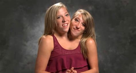 do abby and brittany hensel have one vagina